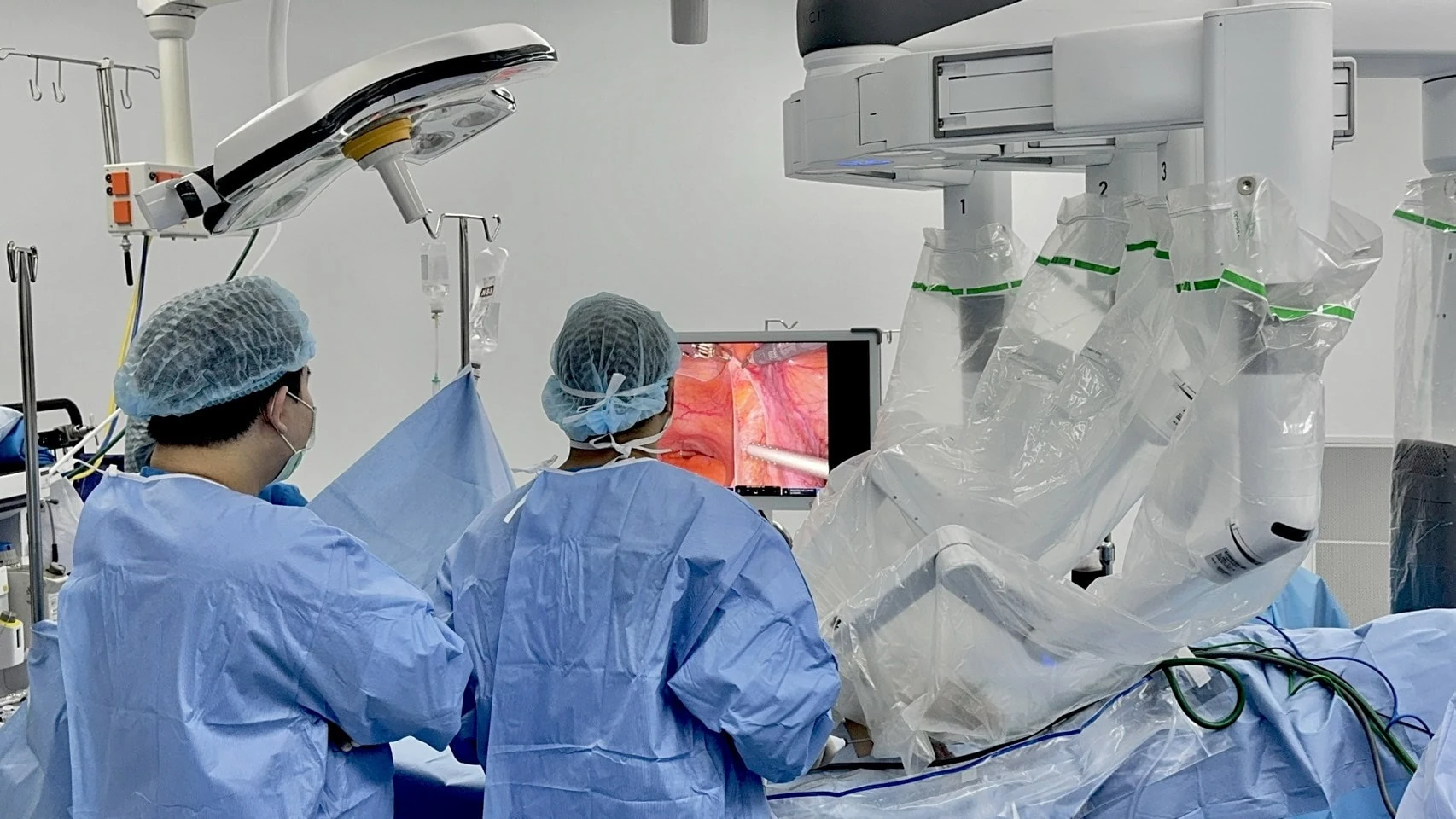 Surgical team views the monitor beside the Da Vinci robotic system at Vejthani